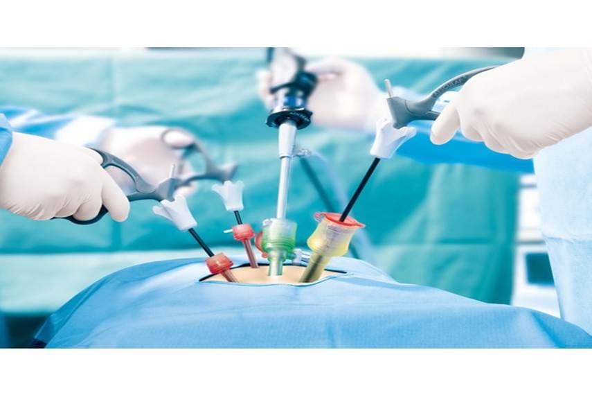 Advance Laparoscopic Surgery